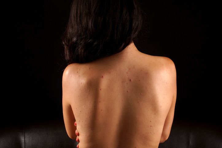 The Ultimate Guide To Understanding Back Facial Treatment!