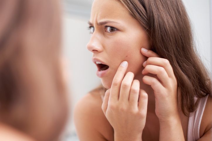 Best Acne Treatment in Australia for You!