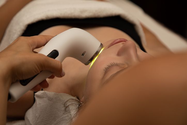The Ultimate Guide to Laser Facial  Pigmentation Removal Treatment!